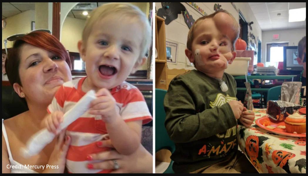 A-5-year-old-Boy-Who-survived-a-Vicious-Attack-by-Two-Dogs