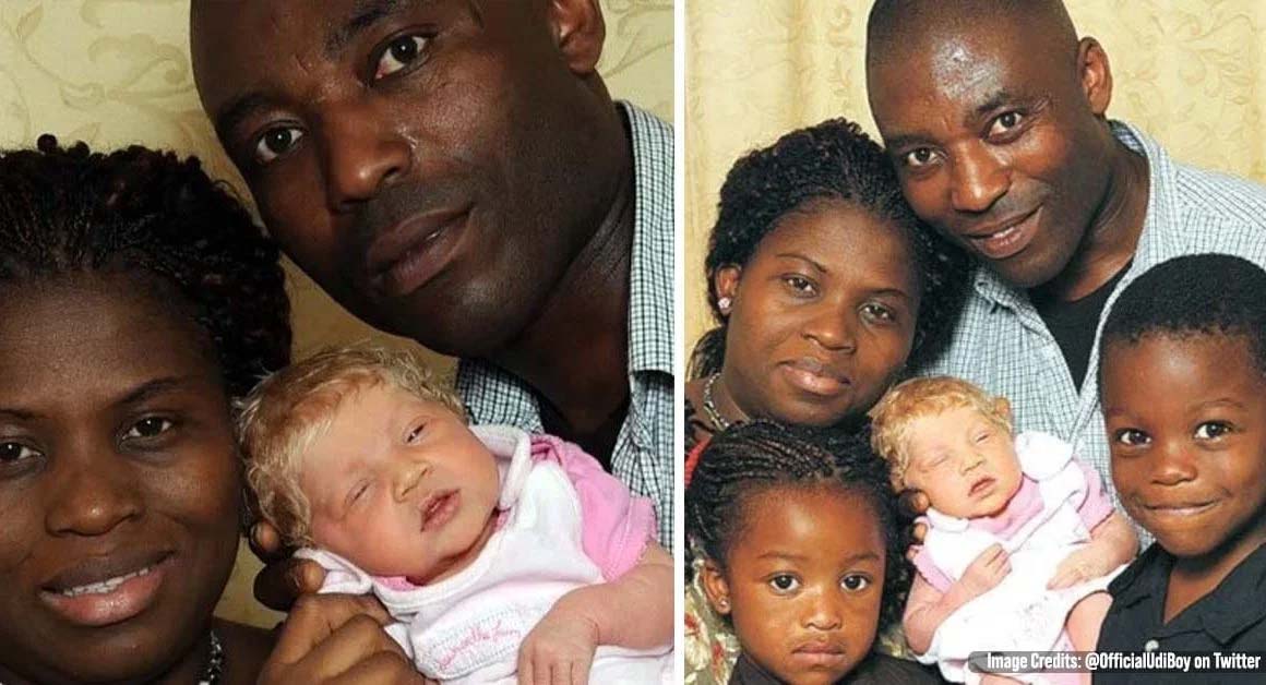 A Nigerian Black Couple Welcomed Blonde, Blue-eyed Child